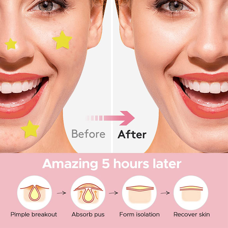 แผ่นแปะสิวรูปดาว 600 ชิ้น/ชุด  - Beauty With Makeup บทวิจารณ์และราคา